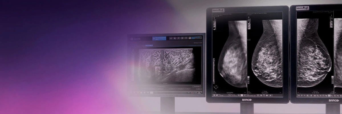 Mammography
