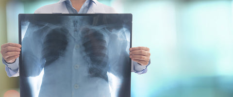 Refurbished X-Ray