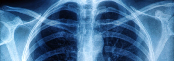Digital X-Ray
